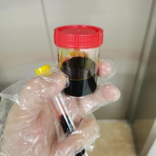 急性肝衰竭！兩兄弟誤吃這種菌 專家提醒