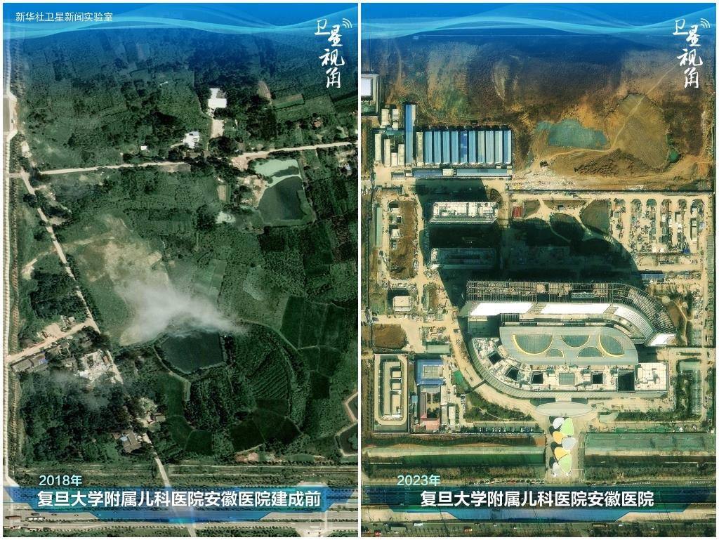2023年與2018年相比，復(fù)旦大學(xué)附屬兒科醫(yī)院安徽醫(yī)院從一片荒地到建成投用。該項(xiàng)目是安徽省在長三角一體化高質(zhì)量發(fā)展衛(wèi)生健康領(lǐng)域的重大項(xiàng)目，也是安徽首批落地的國家區(qū)域醫(yī)療中心。