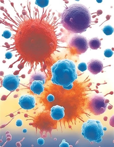 用氯化鈉處理的高活性CD8 T細胞（紫色），與未經處理的細胞（藍色）相比，其抗腫瘤能力更強，能夠顯著損傷腫瘤細胞（紅色）。圖片來源：德國耶拿弗里德里希·席勒大學